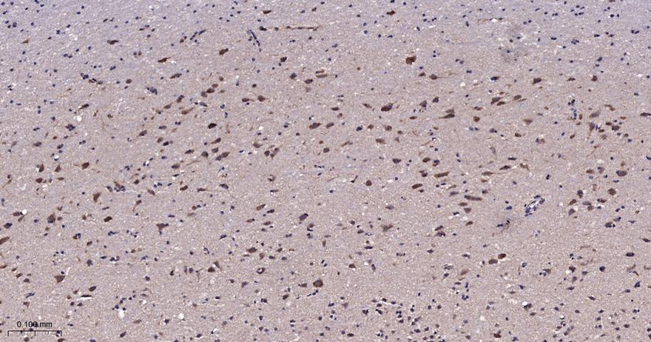 Rabbit anti-TSG101 Monoclonal Antibody