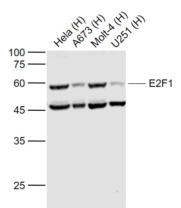Rabbit anti-E2F1 Polyclonal Antibody
