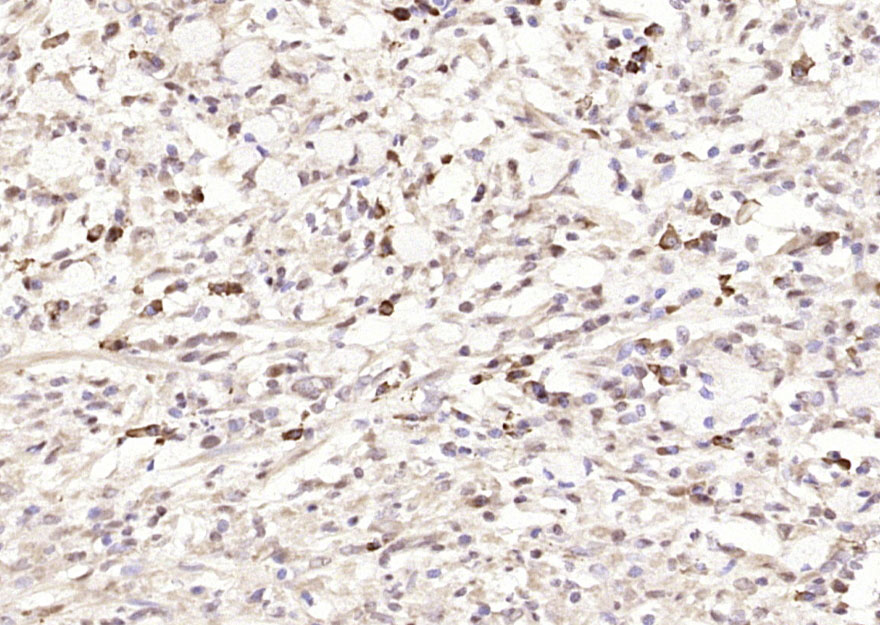 Rabbit anti-VEGF-C Polyclonal Antibody