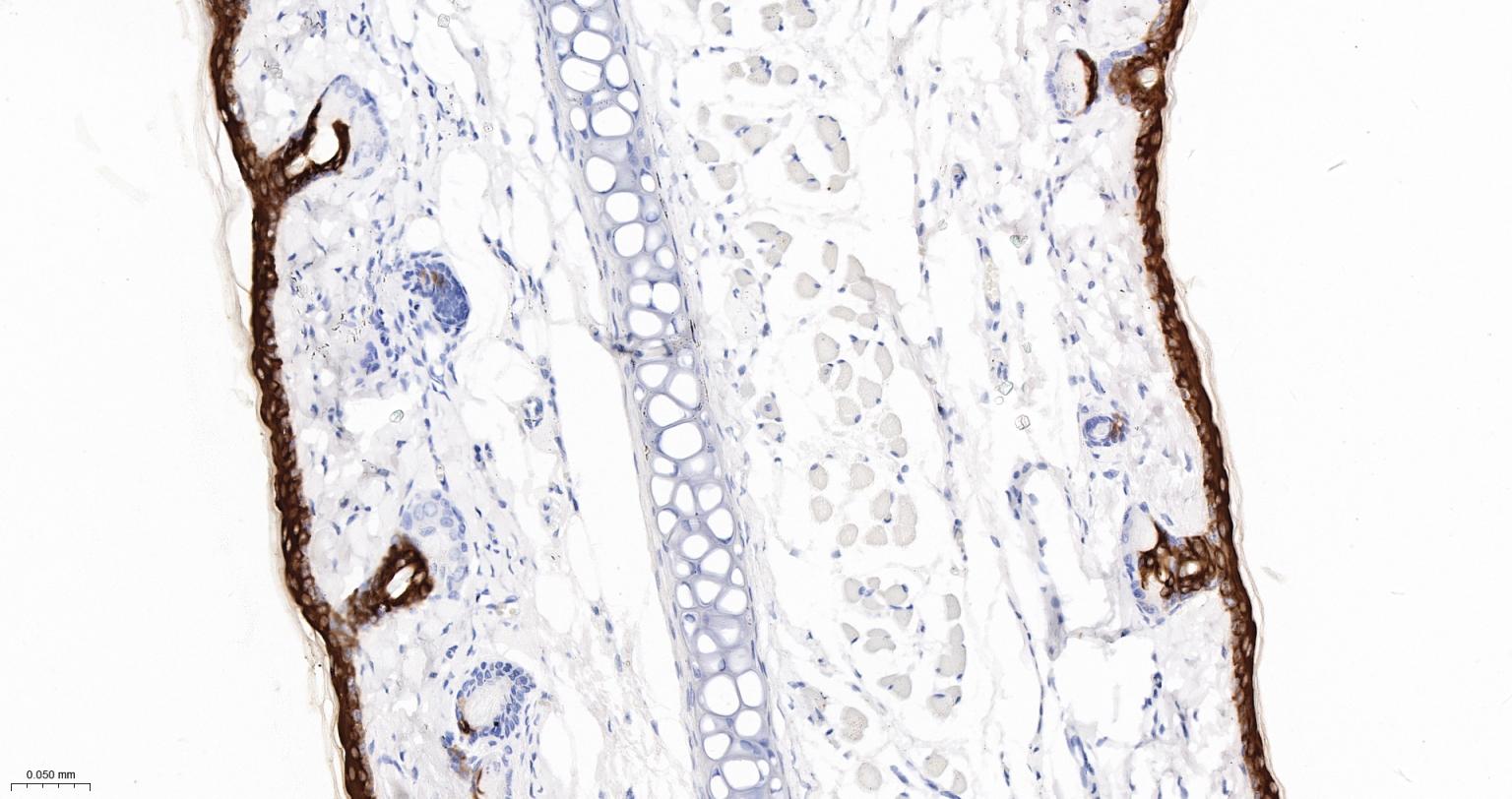 Rabbit anti-CK10/Cytokeratin 10 Monoclonal Antibody