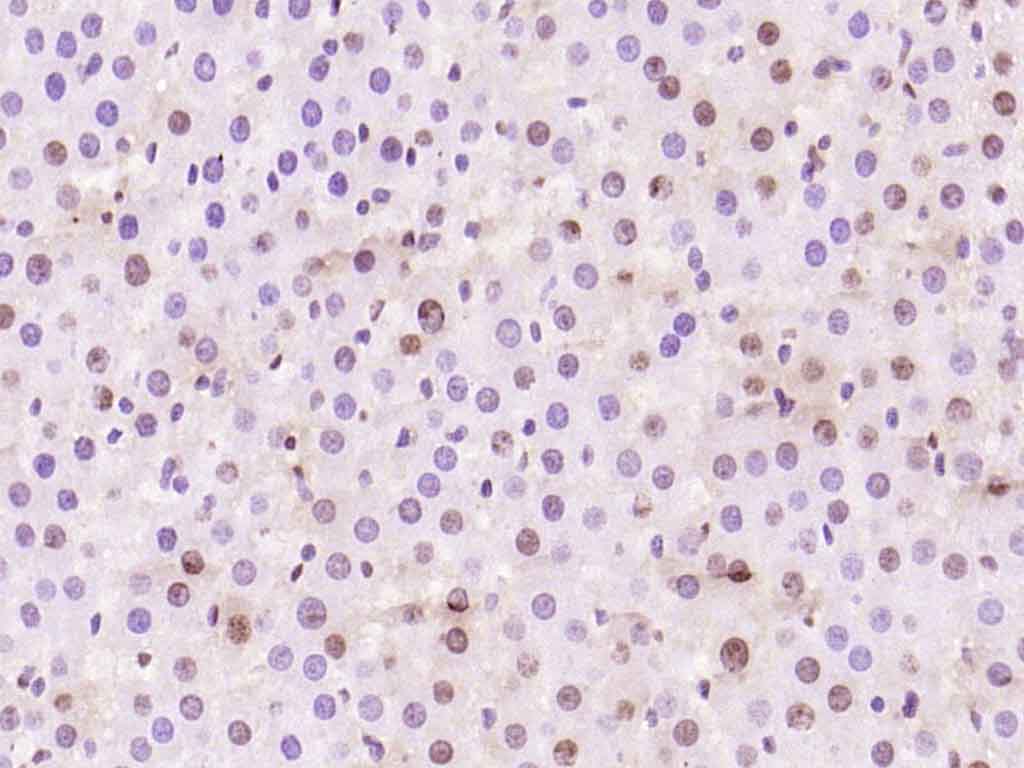 Rabbit anti-Phospho-Histone H1.4(Thr18) Polyclonal Antibody