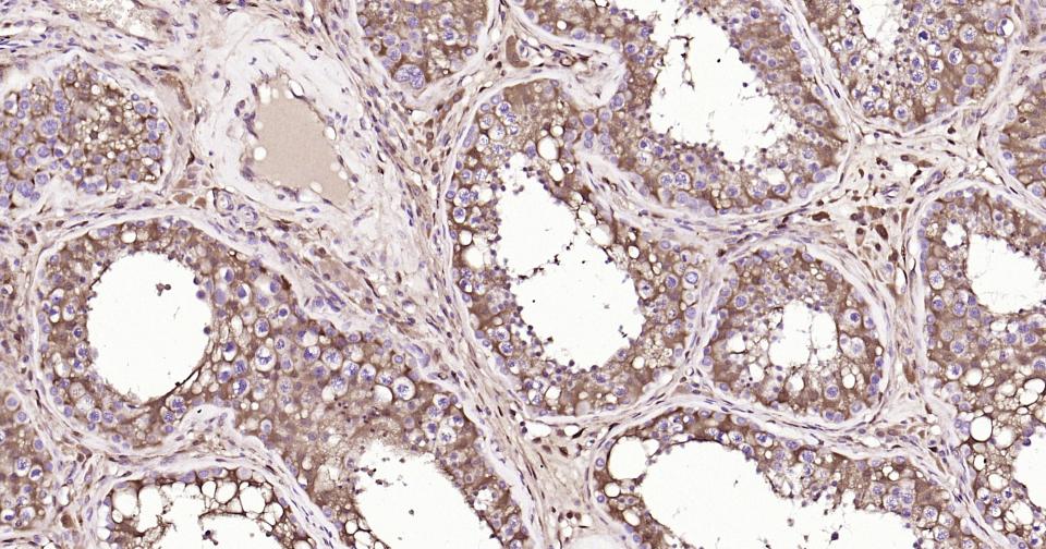 Rabbit anti-Galectin 3 Polyclonal Antibody