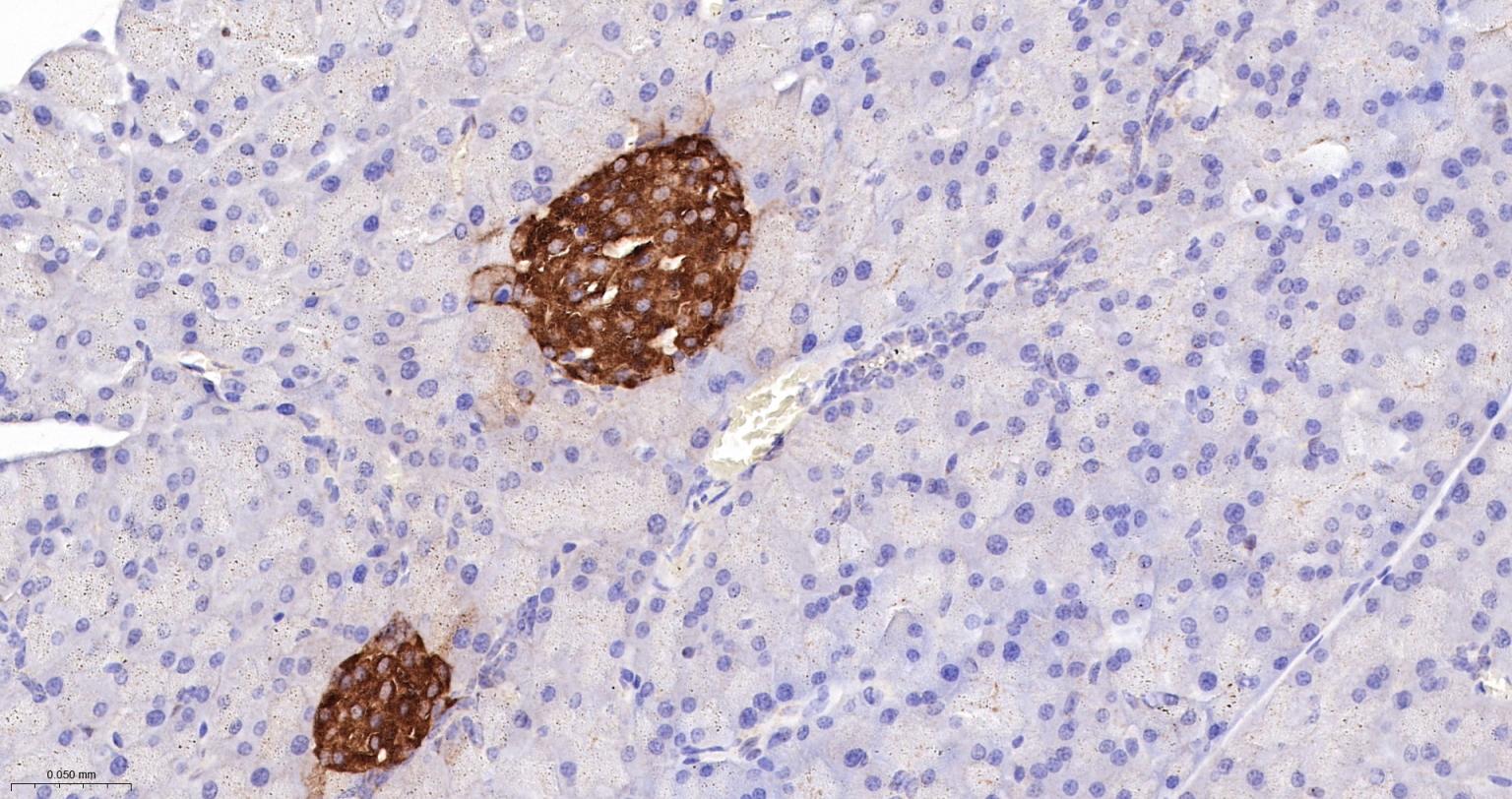 Rat anti-PTEN Monoclonal Antibody