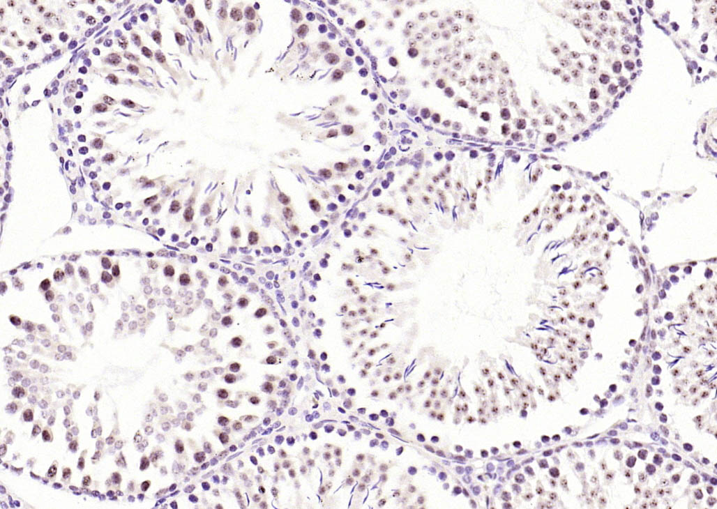 Rabbit anti-Phospho-RPS6KA1(Ser380) Monoclonal Antibody