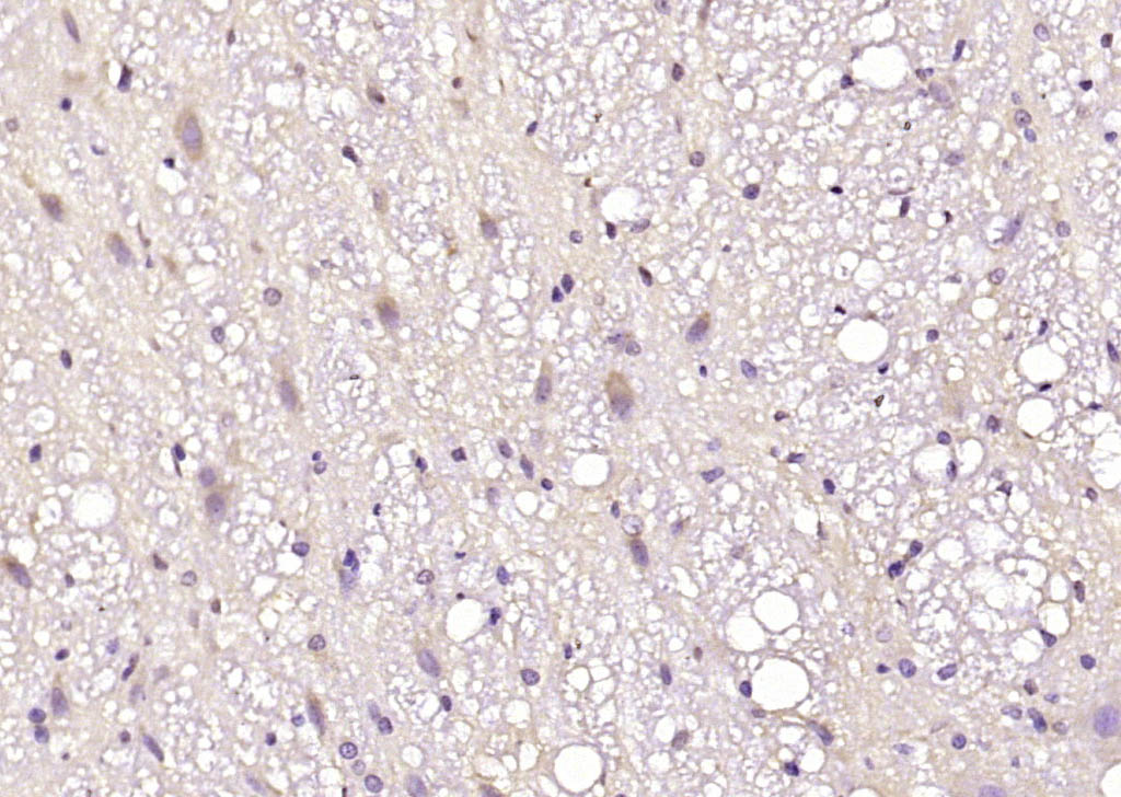Rabbit Anti-MARCH6 Polyclonal Antibody