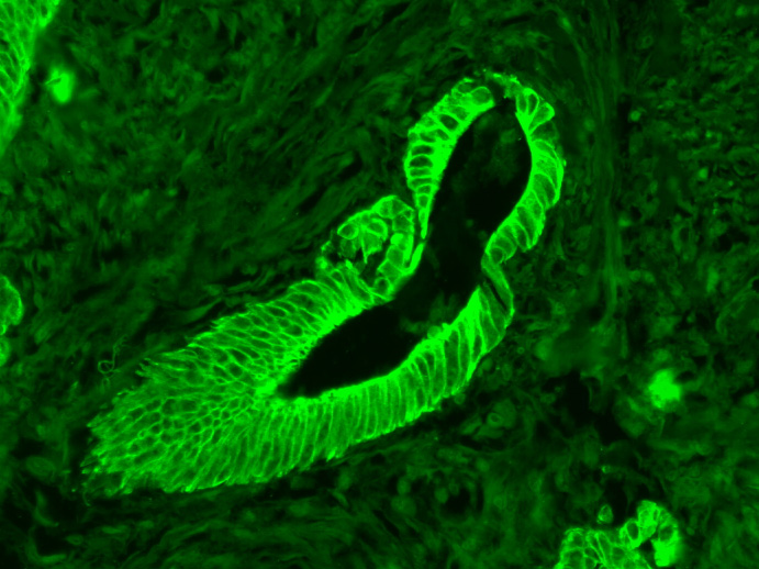 Mouse anti-Cytokeratin 8 Monoclonal Antibody