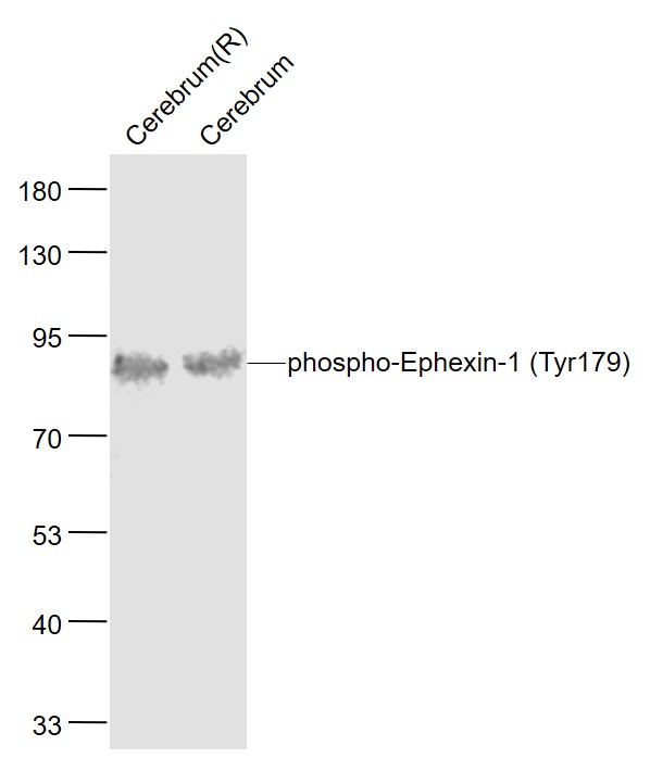 Rabbit anti-Phospho-Ephexin-1(Tyr179) Polyclonal Antibody