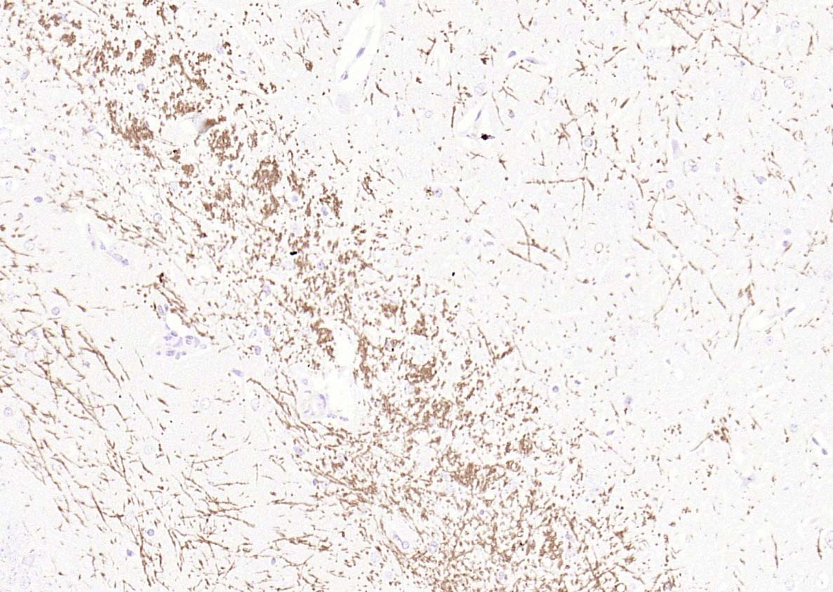 Rabbit anti-MBP Polyclonal Antibody