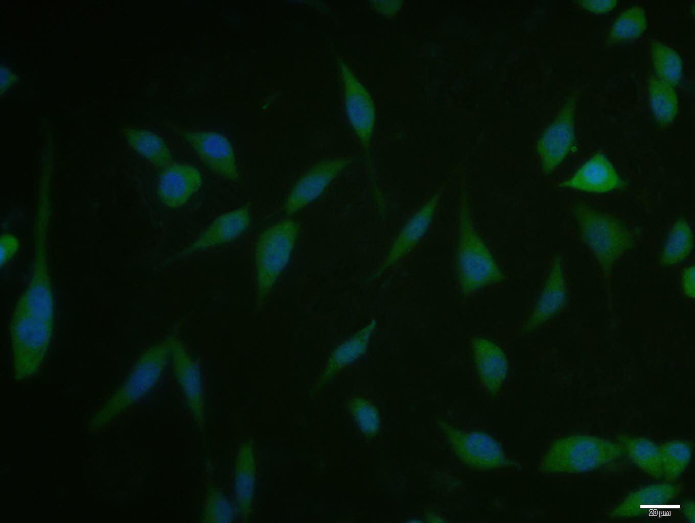 Rabbit anti-Phospho-mTOR(Ser2481) Polyclonal Antibody