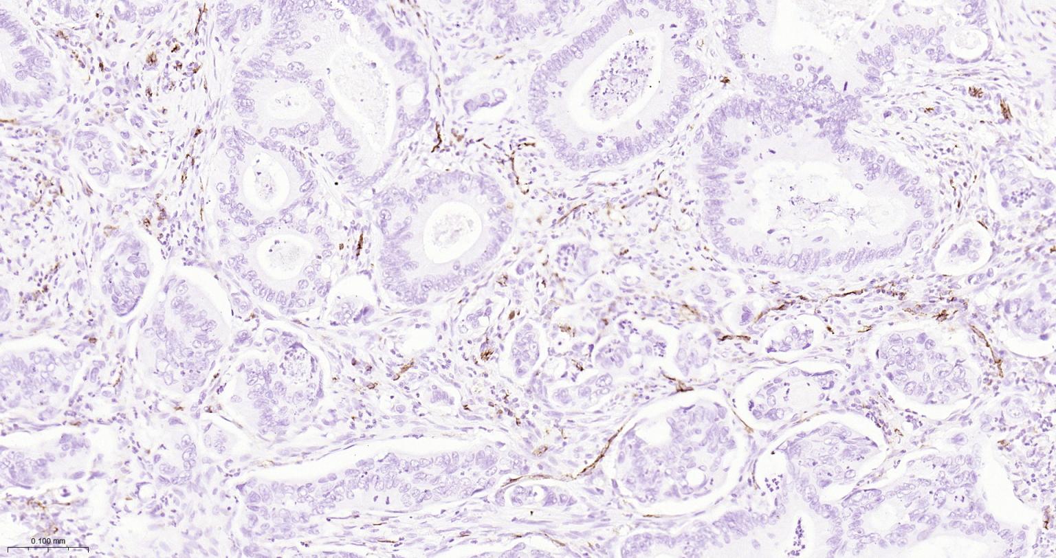 Mouse anti-CD31 Monoclonal Antibody