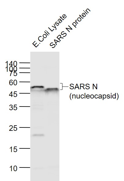 Mouse anti-SARS-CoV Nucleocapsid Monoclonal Antibody