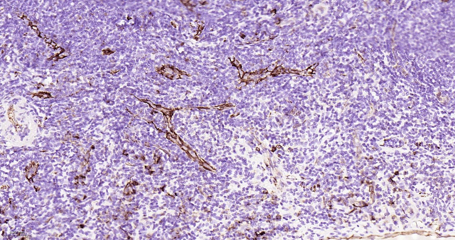 Mouse anti-CD31 Monoclonal Antibody