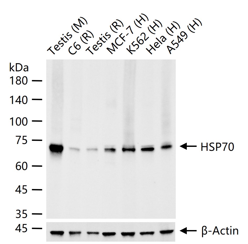 Rabbit anti-HSP70 Monoclonal Antibody