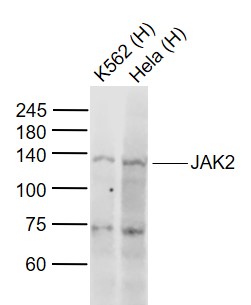 Rabbit anti-JAK2 Polyclonal Antibody