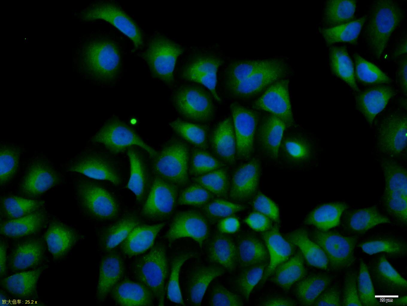 Rabbit anti-RASSF1A Polyclonal Antibody