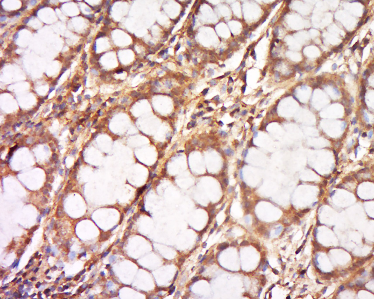 DNCLI1 Polyclonal Antibody