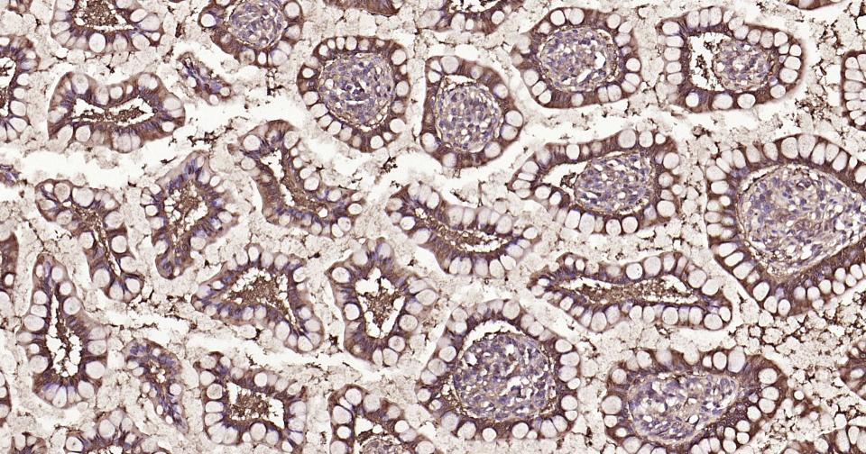 Rabbit anti-Galectin 3 Polyclonal Antibody