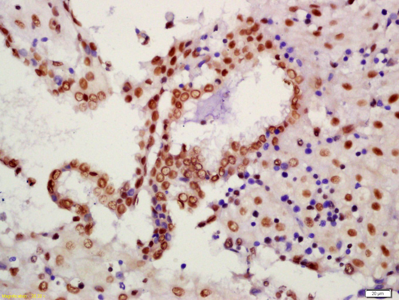 Rabbit anti-Phospho-PTEN(Ser380+Thr382+Thr383) Polyclonal Antibody