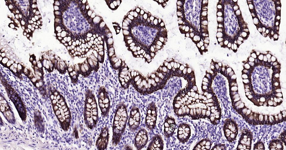 Rabbit anti-CK20 Monoclonal Antibody