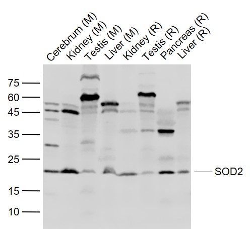 Rabbit anti-SOD2 Polyclonal Antibody