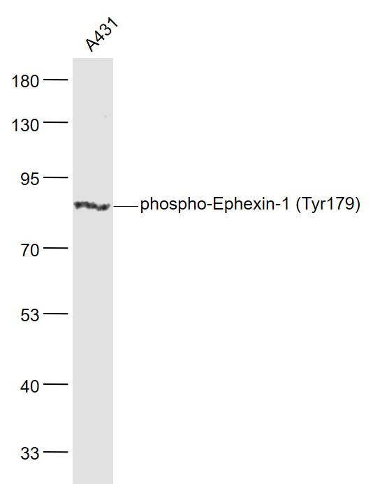 Rabbit anti-Phospho-Ephexin-1(Tyr179) Polyclonal Antibody