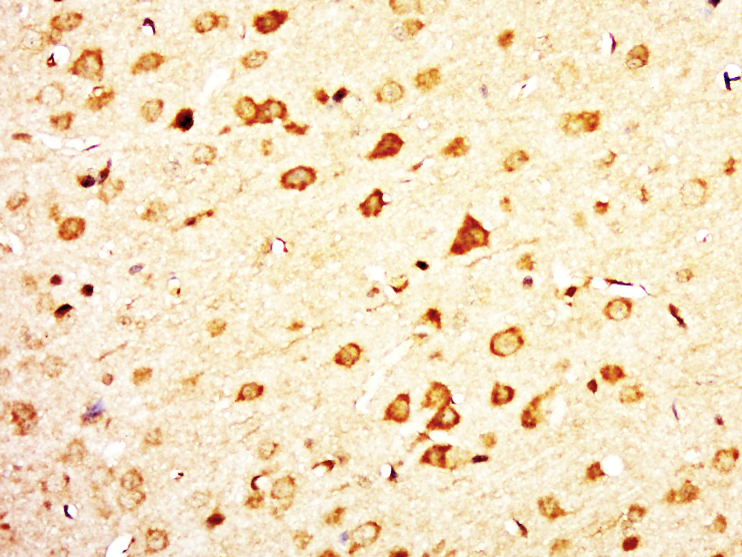 Rabbit Anti-C12ORF68 Polyclonal Antibody