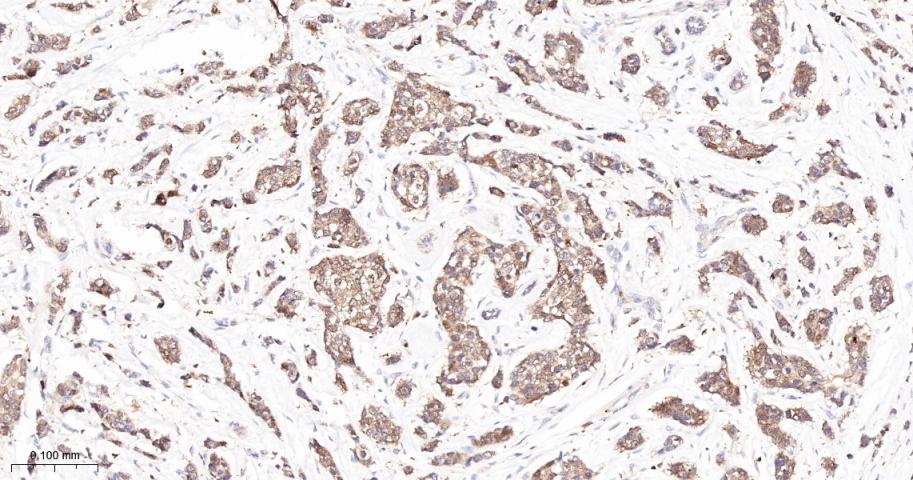 Rabbit anti-PKC δ Monoclonal Antibody