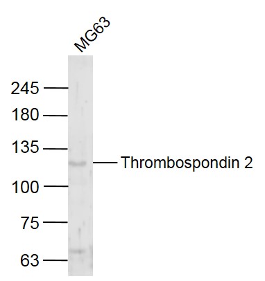 Rabbit anti-Thrombospondin 2 Polyclonal Antibody