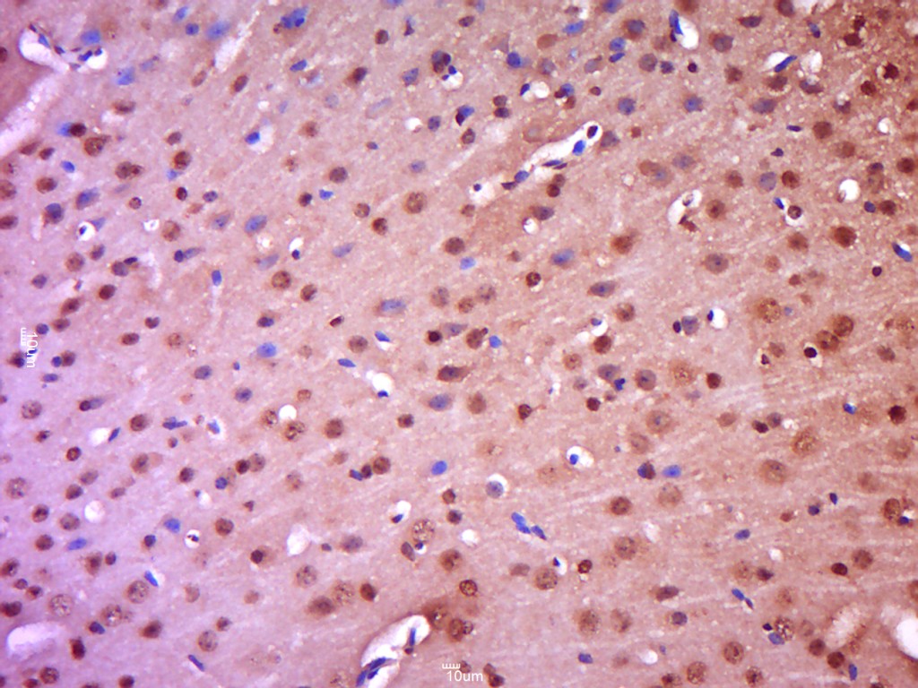 Rabbit anti-Phospho-IKBα(Tyr305) Polyclonal Antibody