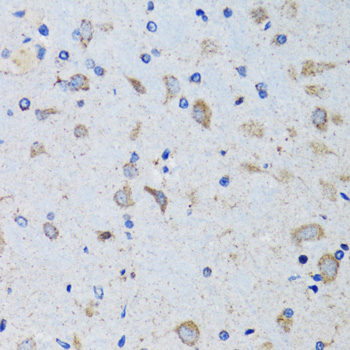 Rabbit anti-PTPN1 Polyclonal Antibody
