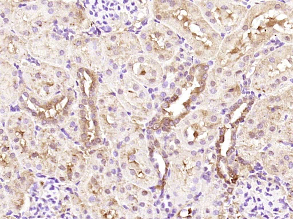 Rabbit anti-EDC4 Polyclonal Antibody