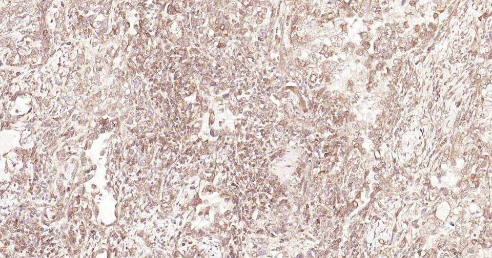 Rabbit anti-Stat3 Monoclonal Antibody