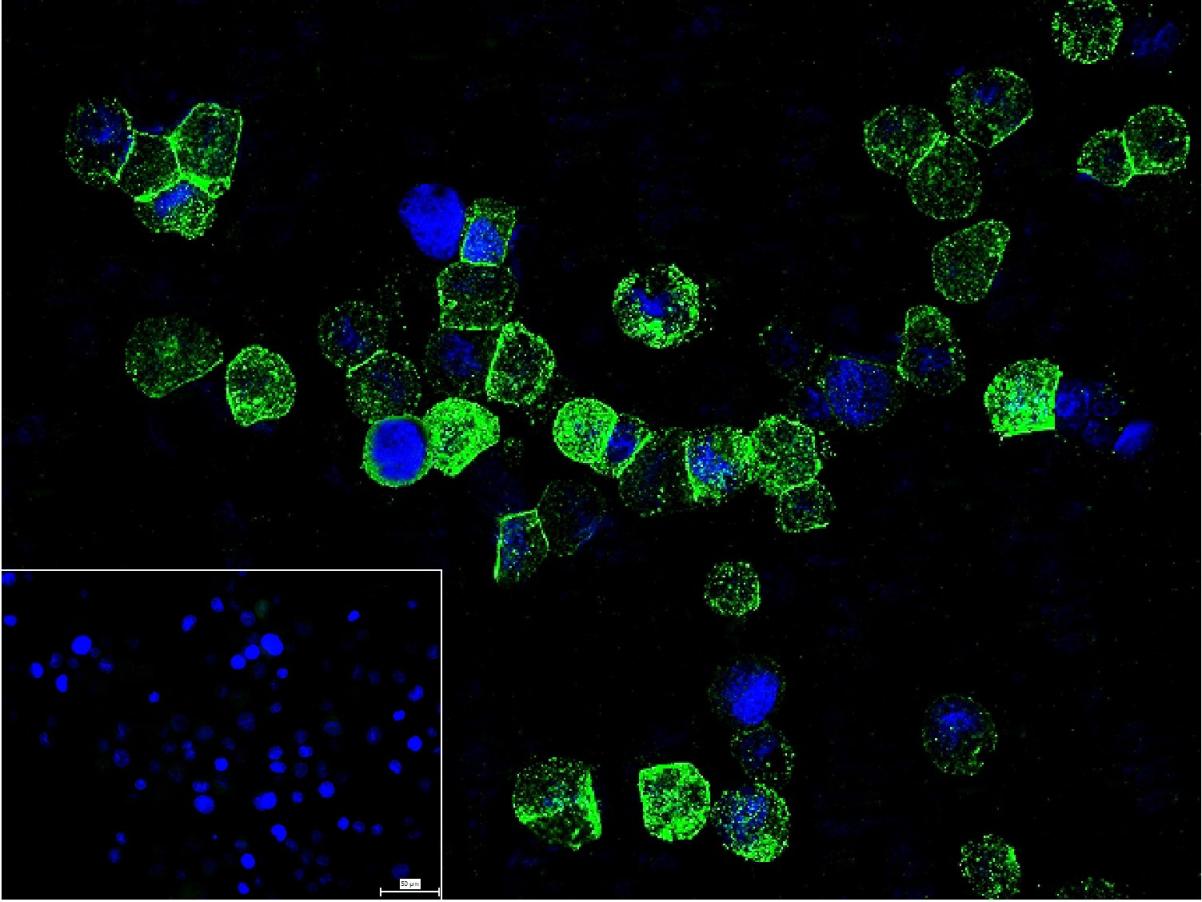 Rabbit anti-TNF α Polyclonal Antibody