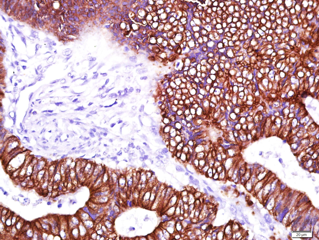 Mouse anti-Cytokeratin 8 Monoclonal Antibody