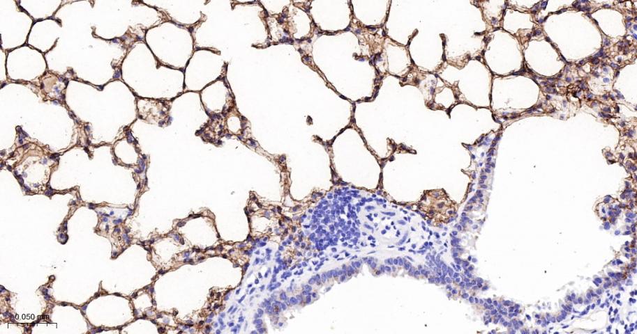 Rabbit anti-RAGE Monoclonal Antibody