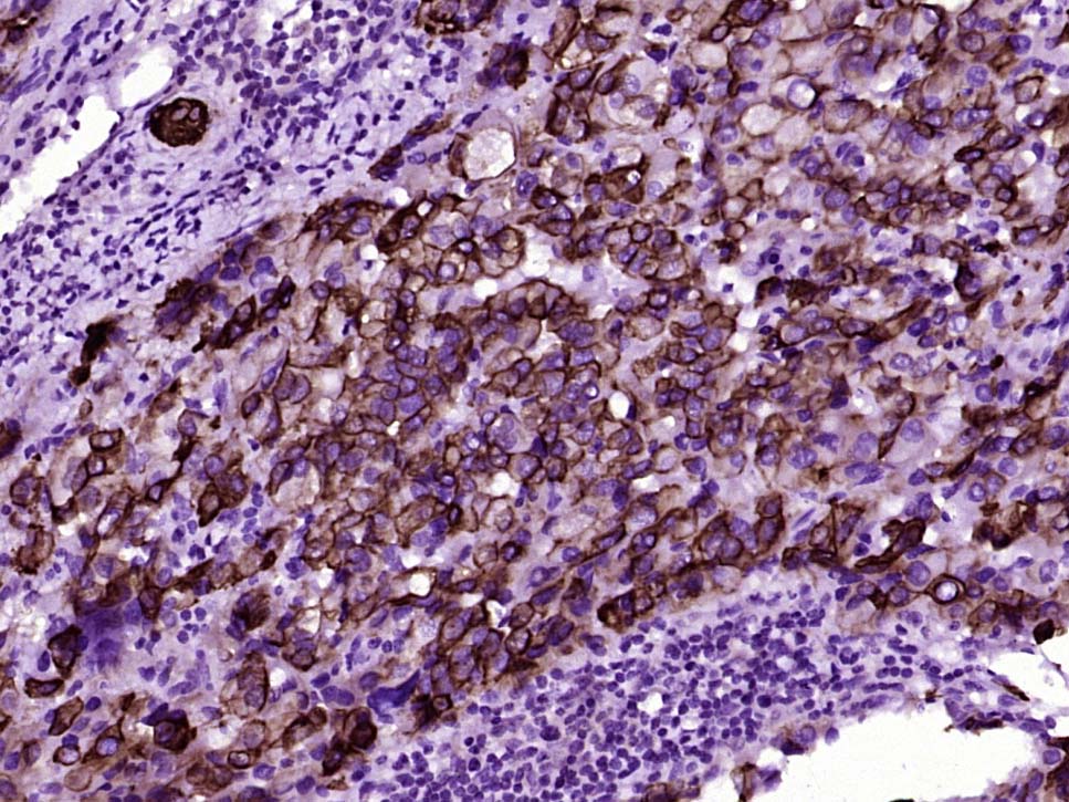 Mouse anti-Cytokeratin 8 Monoclonal Antibody