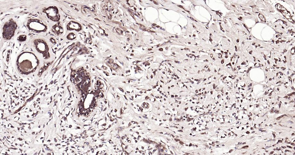 Rabbit anti-β-Tubulin Polyclonal Antibody