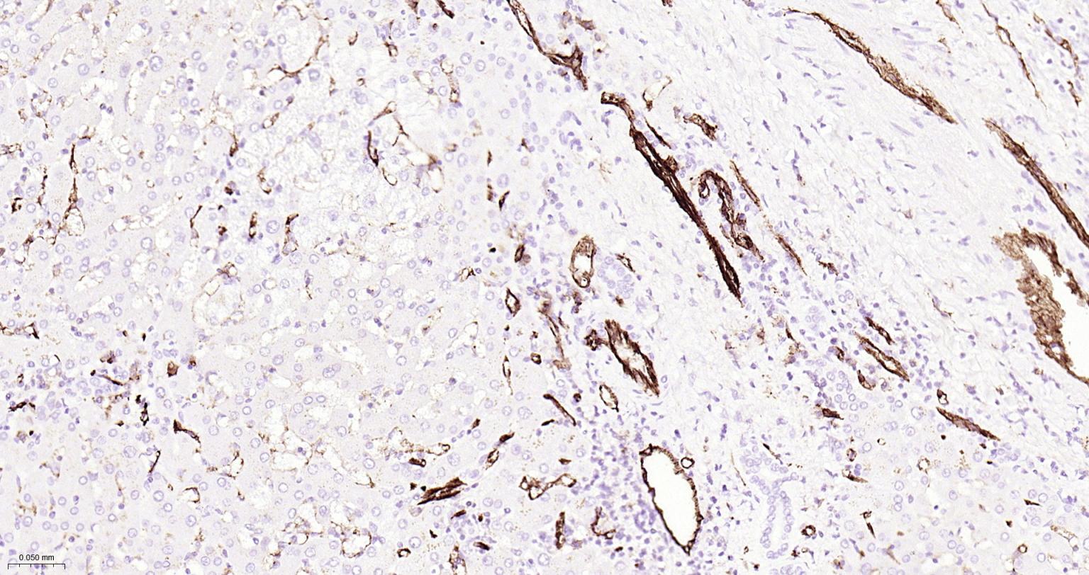 Mouse anti-CD31 Monoclonal Antibody