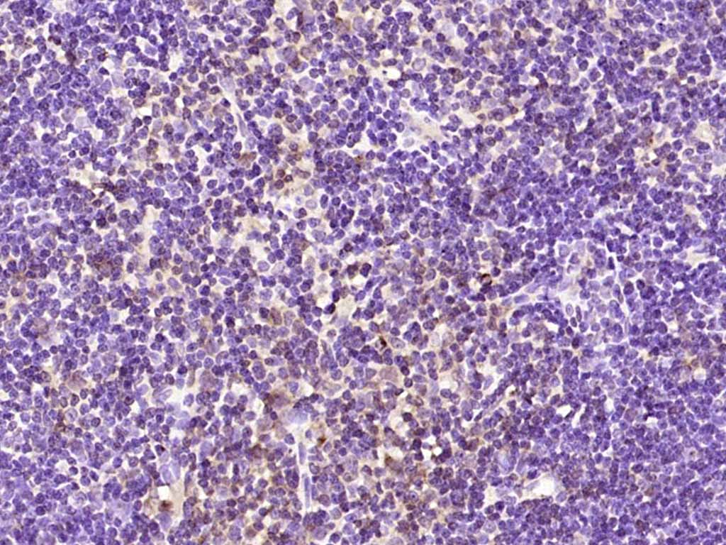 Rabbit anti-Phospho-PKC δ(Ser645) Polyclonal Antibody