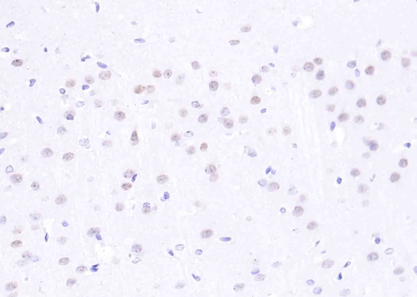 Rabbit anti-Histone H2A.x Polyclonal Antibody