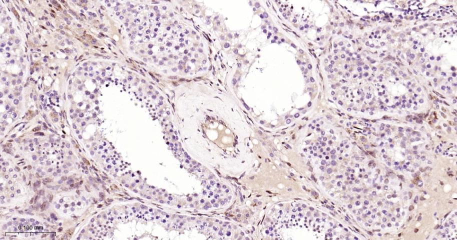 Rabbit anti-bFGF Monoclonal Antibody