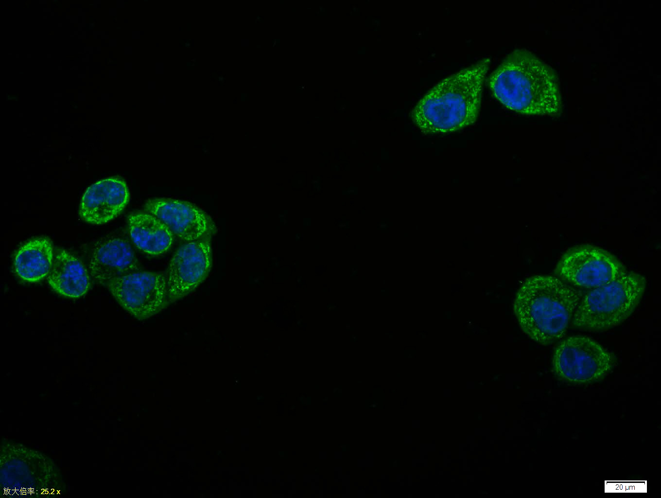 Rabbit anti-Phospho-NFKB p65(Thr435) Polyclonal Antibody