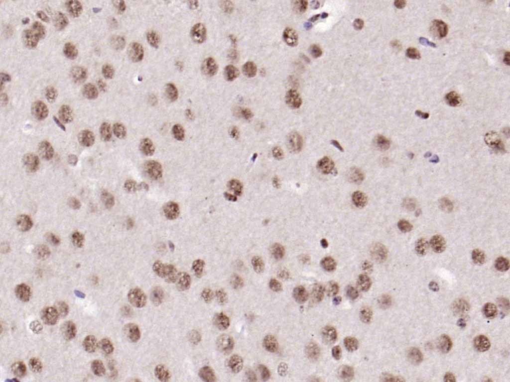 Rabbit anti-UBF1 Polyclonal Antibody