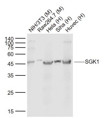 Mouse anti-SGK1 Monoclonal Antibody