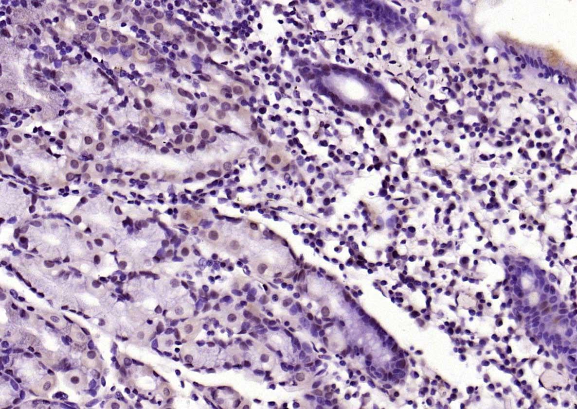 Rabbit anti-Phospho-FADD(Ser194) Polyclonal Antibody