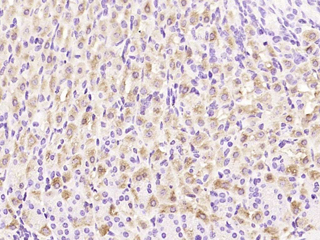Rabbit anti-MRPL20 Polyclonal Antibody