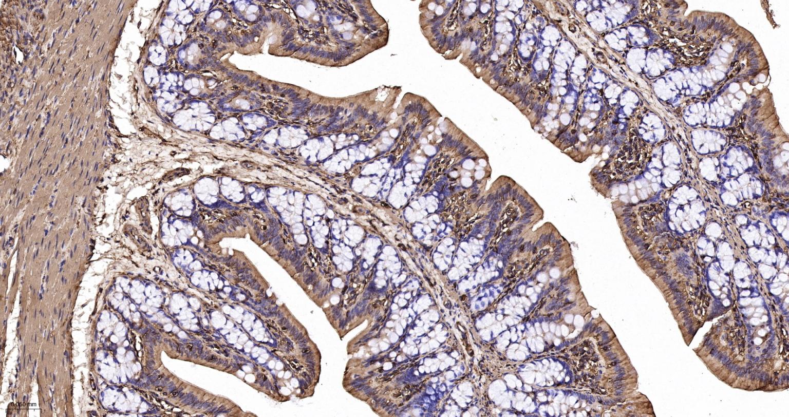 Rabbit anti-α Smooth Muscle Actin Polyclonal Antibody