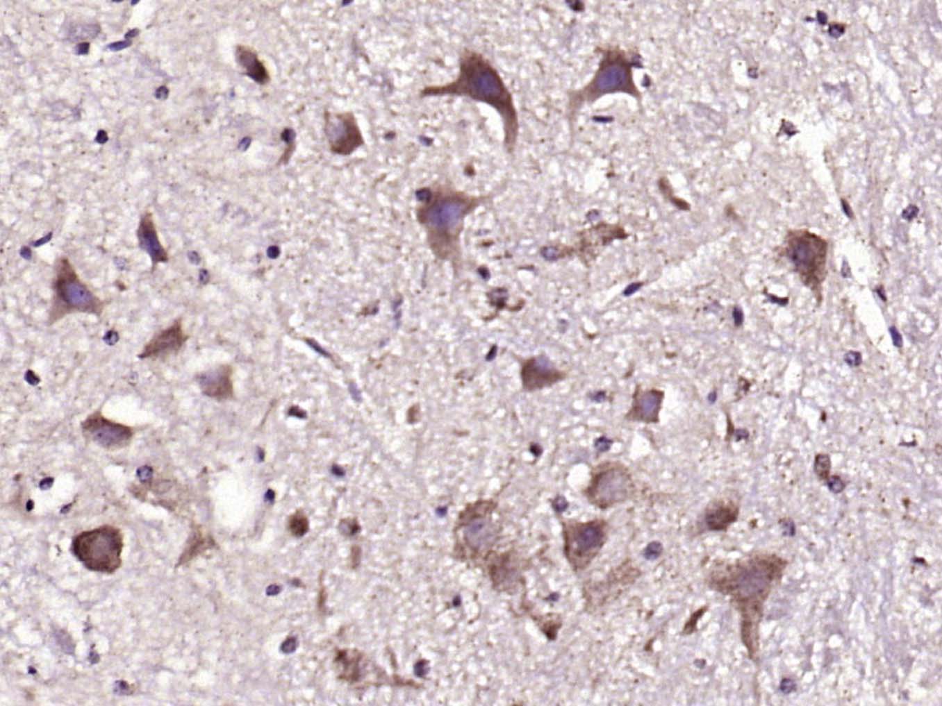 Rabbit anti-PMCA3 Polyclonal Antibody