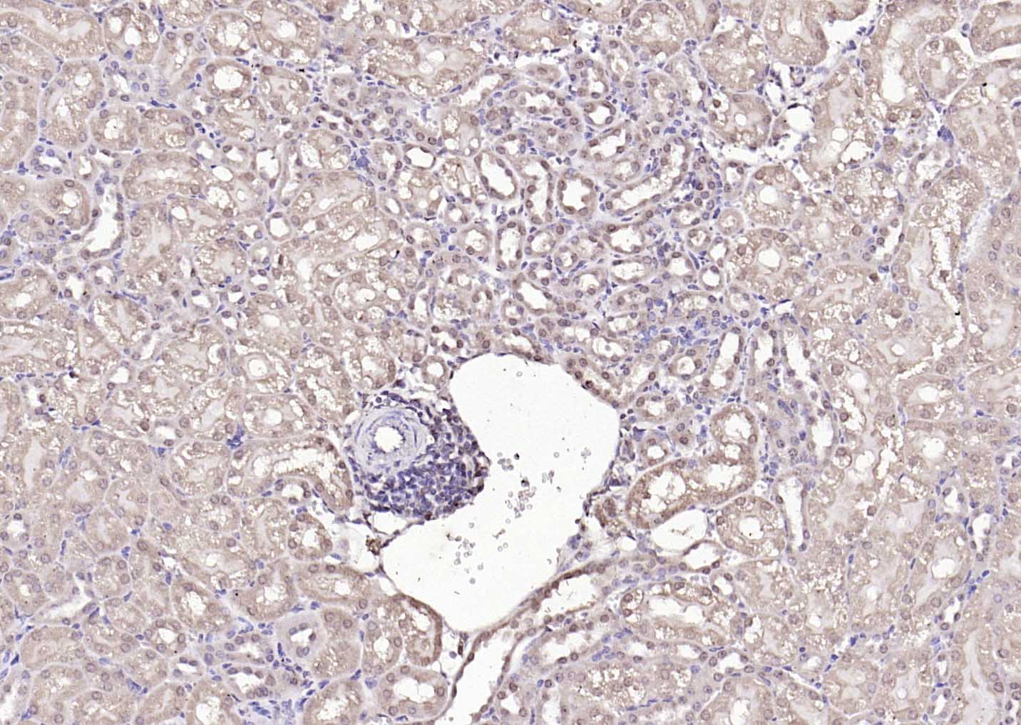 Rabbit anti-Proteasome 20S α1 Polyclonal Antibody