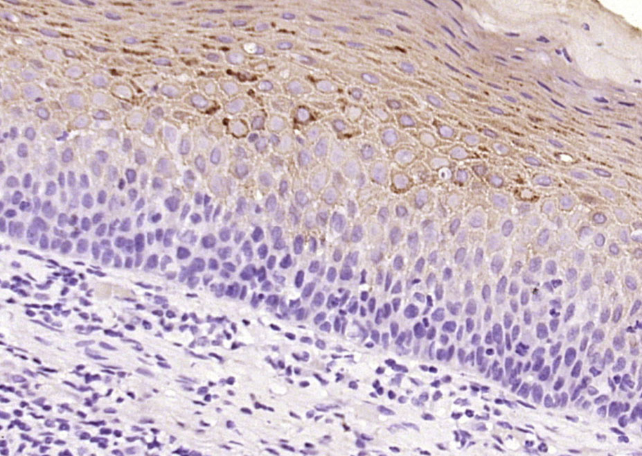 Rabbit anti-Cytokeratin 2e Monoclonal Antibody